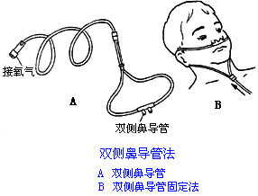 ◆肺病患者如何家庭氧療？